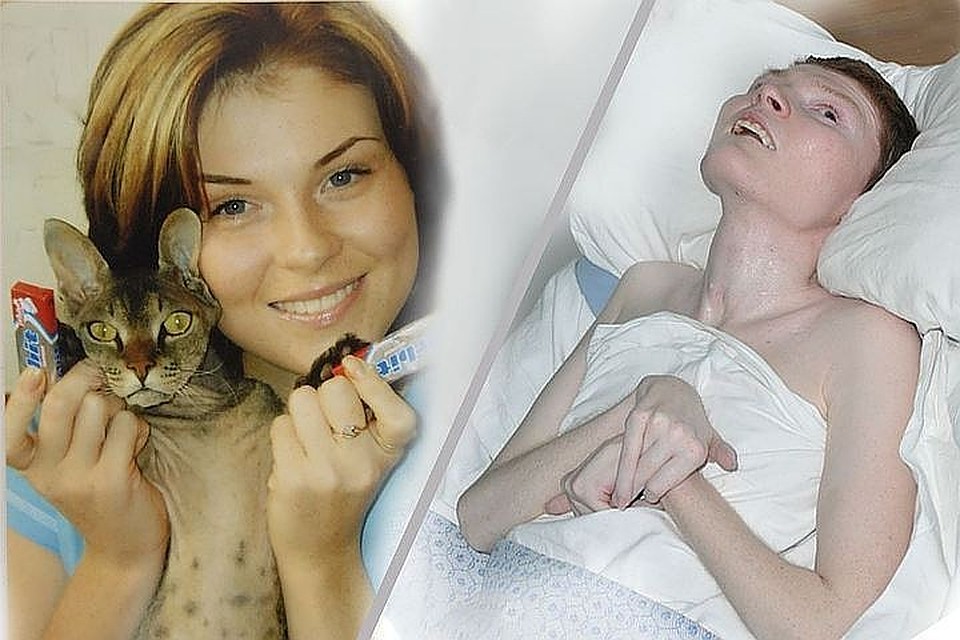 Ирина до и после трагедии