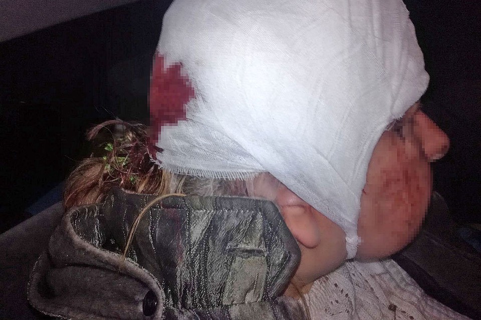 Женщина получила от своего сына серьезную травму головы