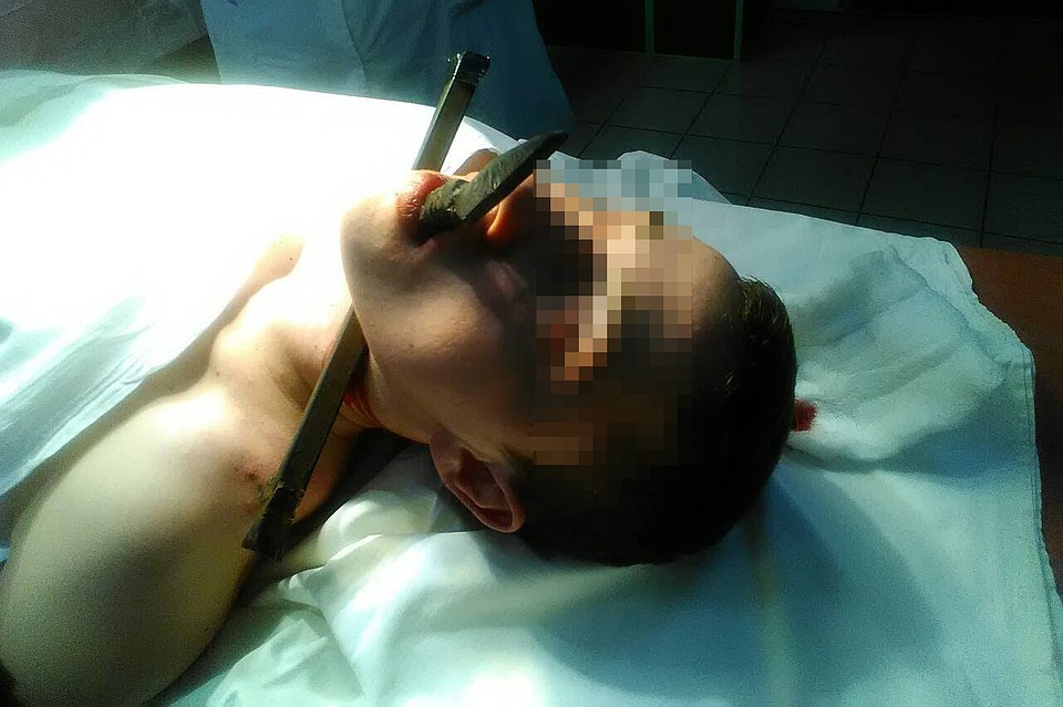 Молодой воронежец начал перелезать через высокий забор, но сорвался и напоролся головой на декоративную пику