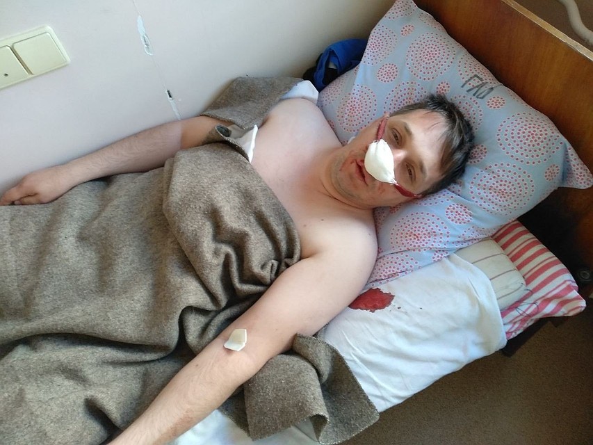 Андрею Пожидаеву сделали несколько операций
