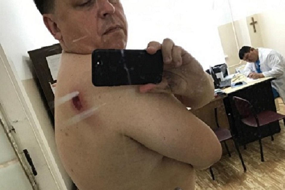 Дмитрий Зайцев получил касательное ранение лопатки. Фото: предоставлено Михаилом Балем