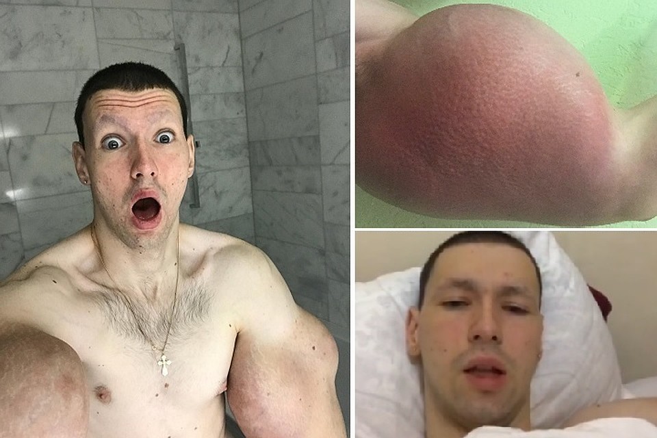 Синтоловый качок задумался о своём здоровье