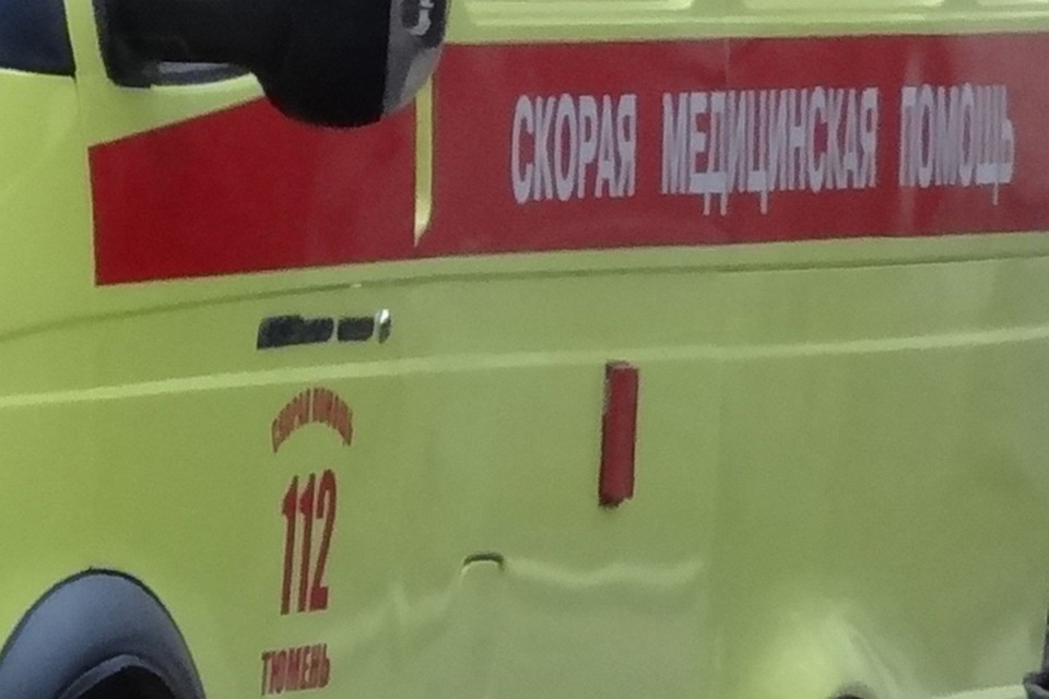 Надымчанка получила серьёзные ожоги