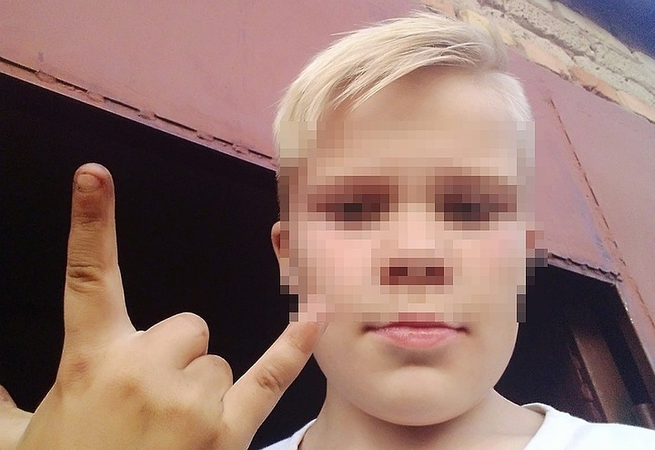 Врачи ампутировали 9-летнему мальчику кисти обеих рук