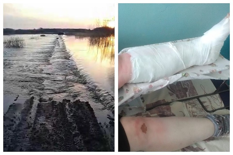Размытая дорога и сломанная нога пенсионерки