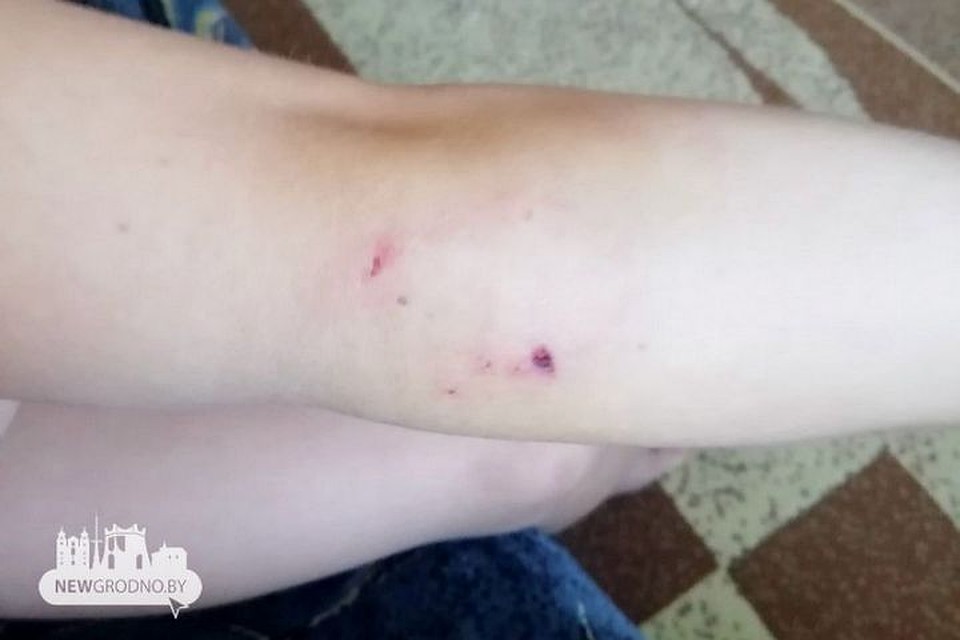 В Гродно в летнем кафе собака укусила 7-летнюю девочку. Фото: newgrodno.by