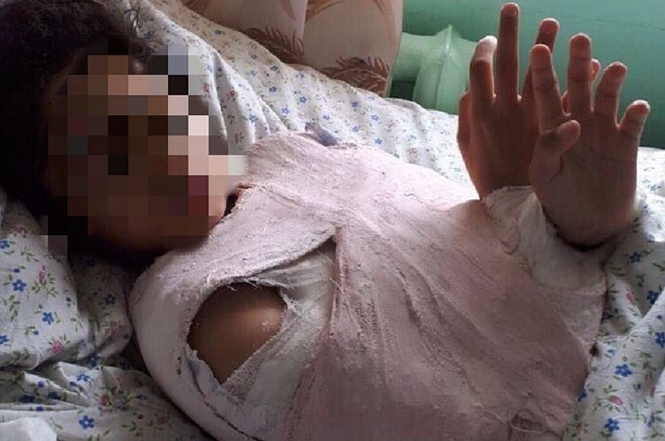 В Ноябрьске девочка упала с качели, переломав плечи Фото: группа "Происшествия Ноябрьск" vk.com