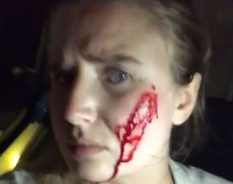Миа рассказала, что дважды вызывала полицию