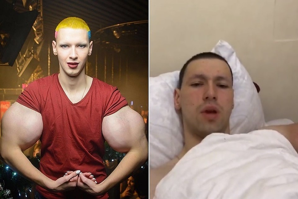 Терешин так надеялся на операцию