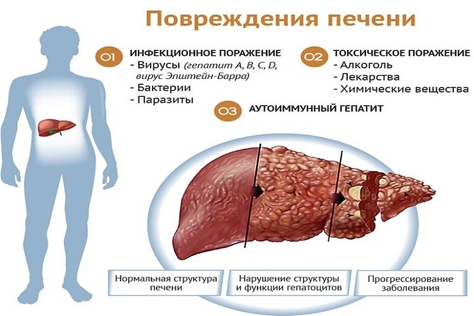 Печень может доставлять немало страданий.