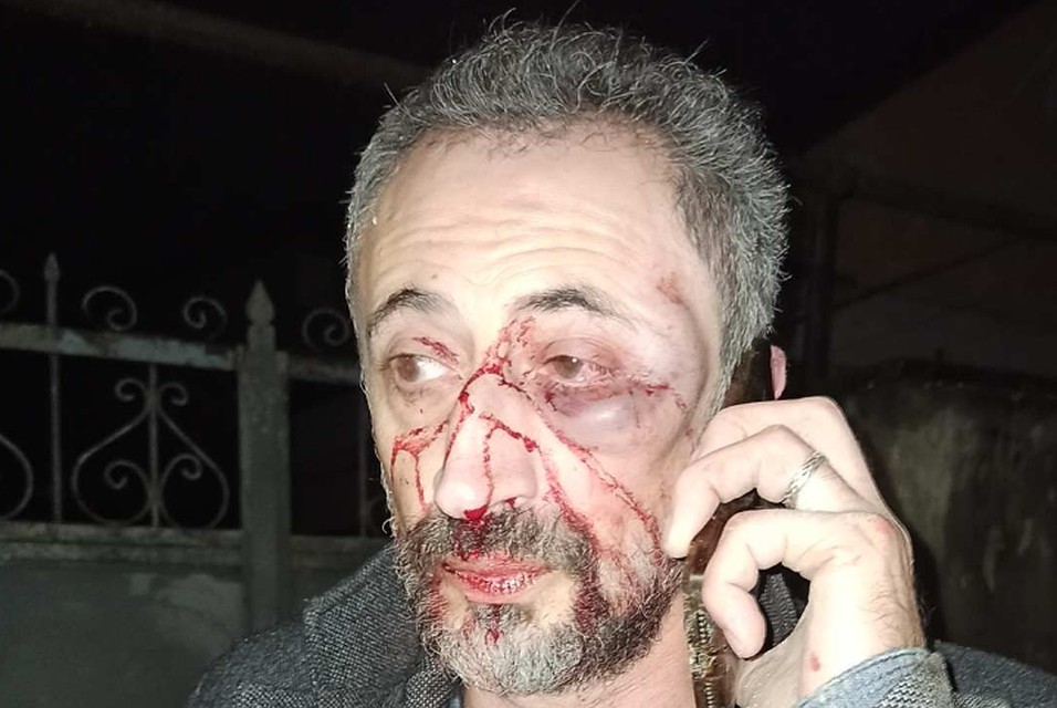 Сразу после избиения Юрий позвонил в полицию. Фото: личный архив