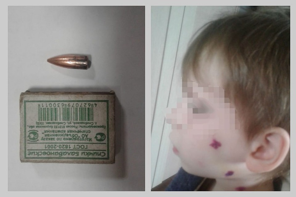 Пьяный сибиряк в новогоднюю ночь палил из оружия в воздух и попал в лицо 6-летнему мальчику. Фото предоставлено героем публикации.