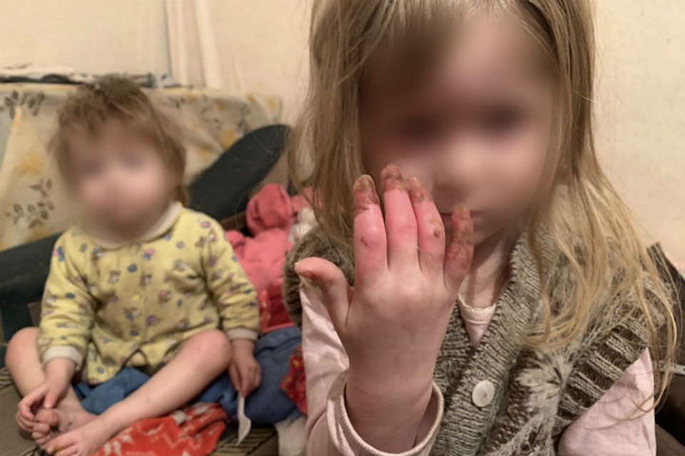 "Давно ничего не ели": в Бурятии мать бросила малышей одних, они голодали,у старшей обморожены руки.