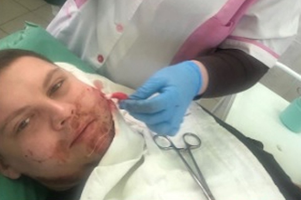 Максим Микрюков оказался в больнице.