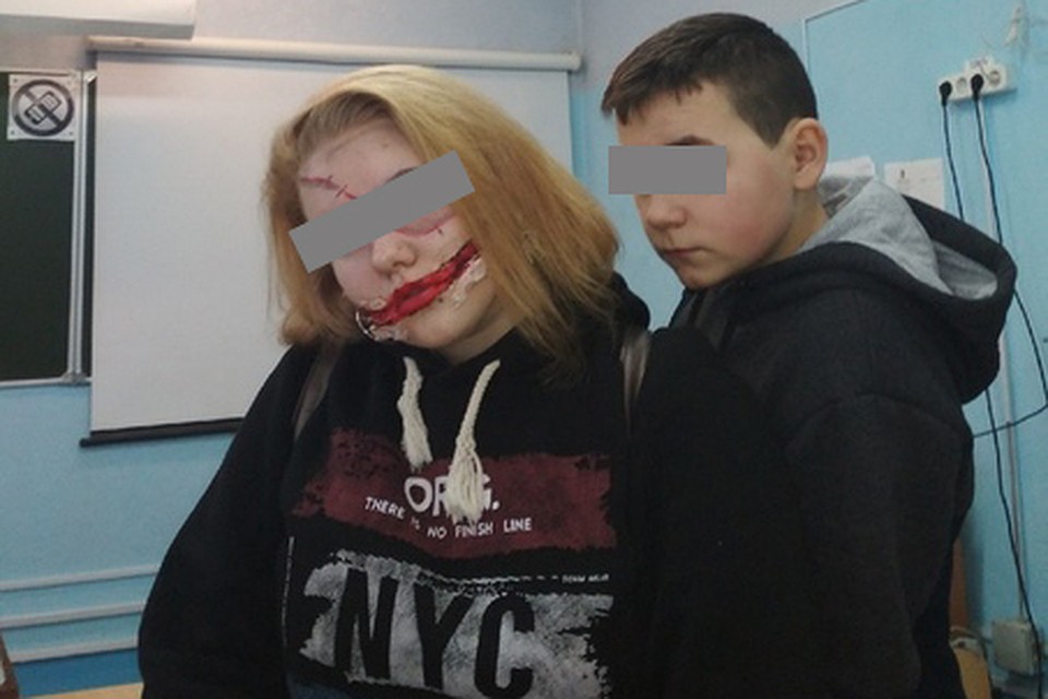 Следовтаели проверят тех, кто должен был наблюдать за поведением Дениса.