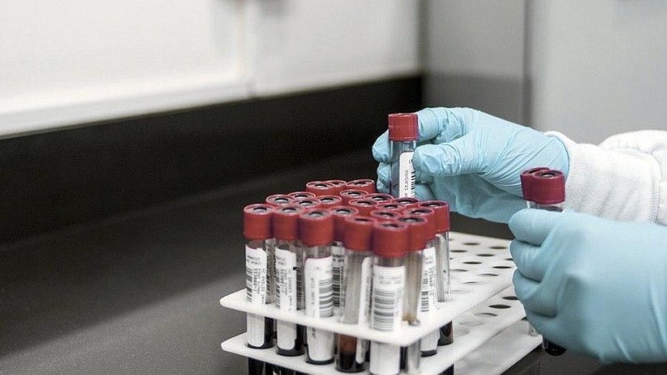Число зараженных под наблюдением в Казахстане выросло до 666 человек
