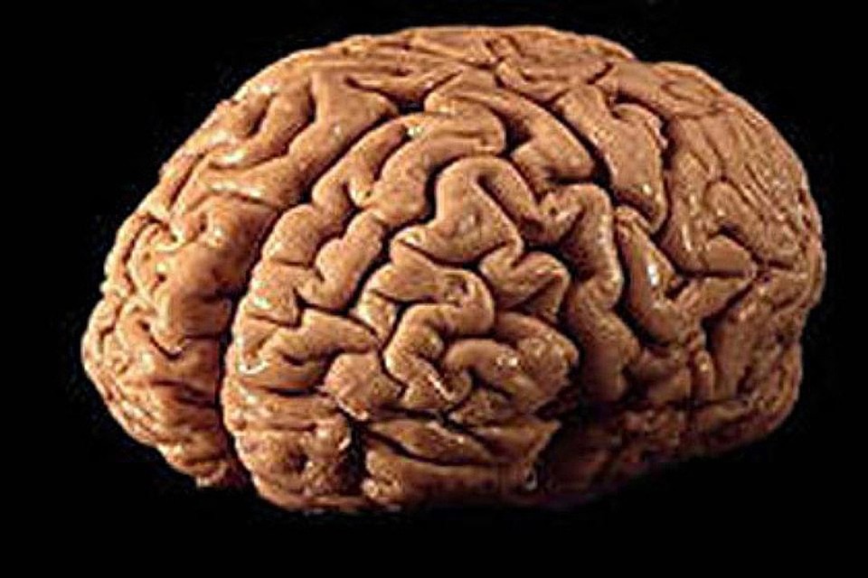 Но многие врачи склоняются к тому, что , что употребление даже малых доз алкоголя способно привести к деградации мозга. Фото: REUTERS