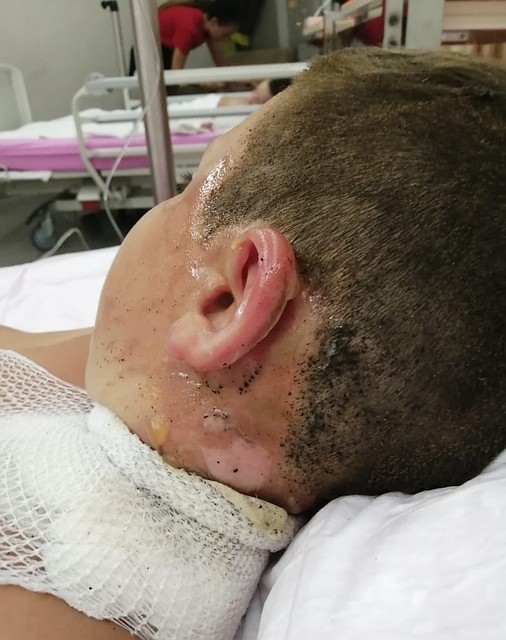 Отец детей надеется завтра вылететь домой, чтобы продолжить лечение в "Девятке". Фото: взято с E1.RU