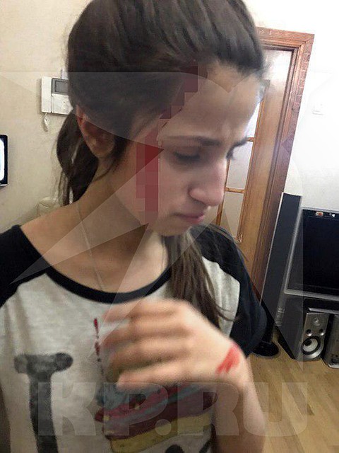 Мария сфотографировала окровавленную Ангелину, после очередного избиения отцом.
