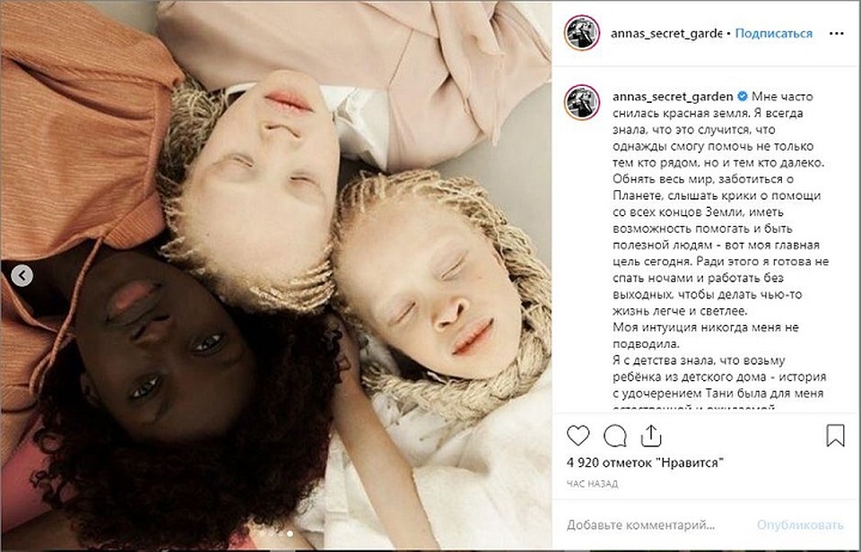 Анна Семак мечтает помогать детям-альбиносам. Фото: instagram.com/annas_secret_garden