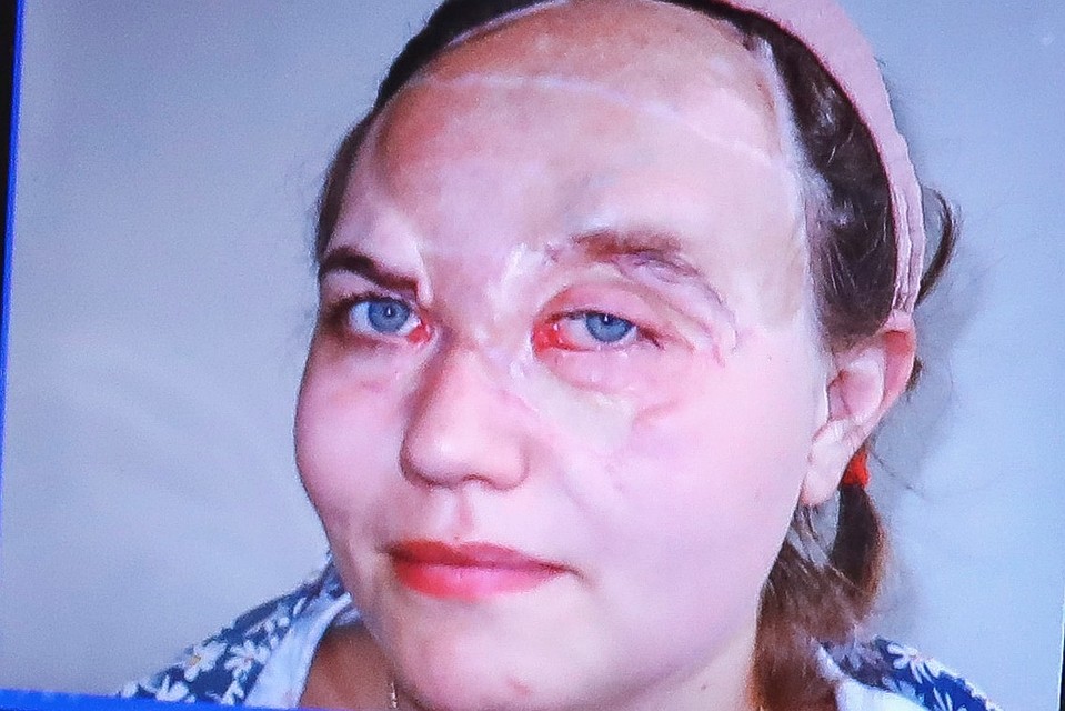 Ксения результатом довольна. Фото: НИИ-ККБ №1.