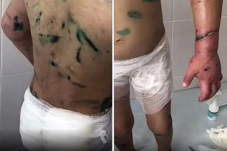 Тело девочки выглядело так, будто на протяжении многих месяцев её пытали