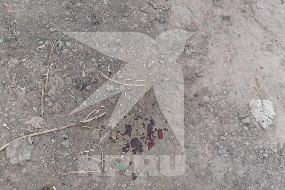 В результате ЧП мужчина получил травмы лица. Фото: Архив "КП"