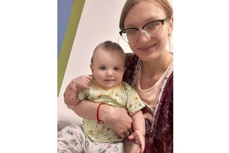 Родители малышки долгое время искали врачей, которые помогут их дочери Фото: Личная страничка героя публикации в соцсети