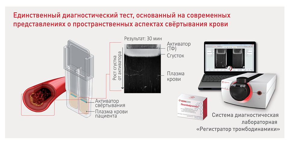 Пресс-служба «ГемаКор»