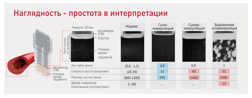 Пресс-служба «ГемаКор»