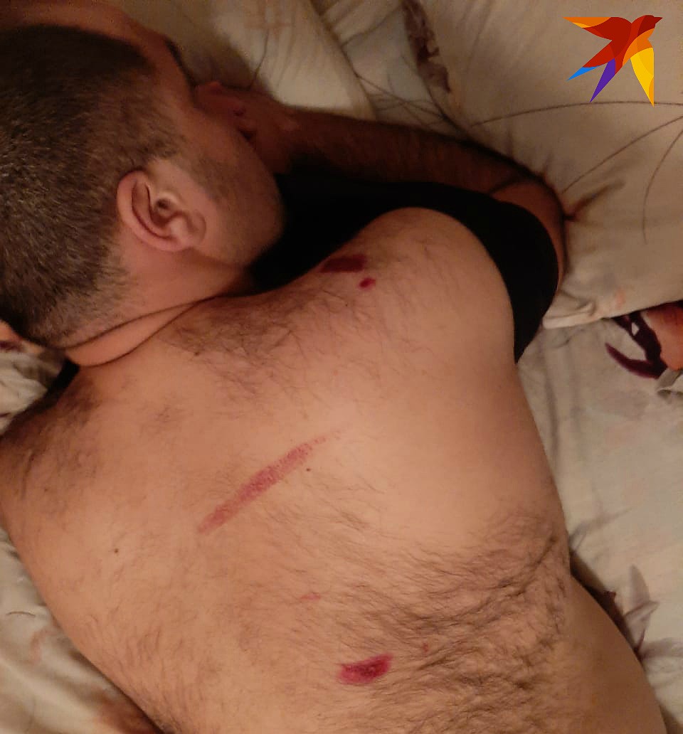 После происшествия мужчин увезли в приемный покой.