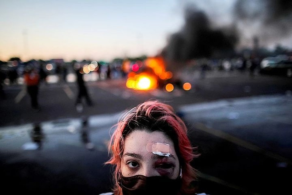 Многие получили травмы во время противостояния. Фото: REUTERS.