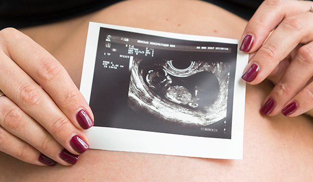 Угроза прерывания беременности