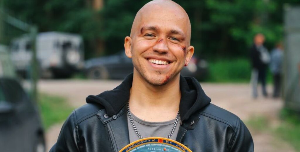 Сергей Романович не носит пересаженную бороду и остался почти без волос