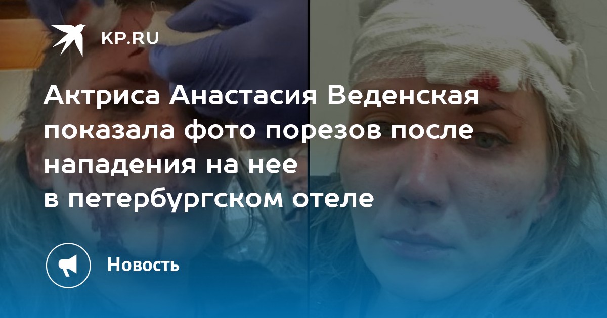 Актриса Анастасия Веденская показала фото порезов после