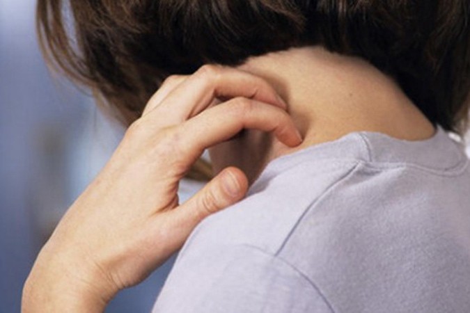 Как справиться с псориазом? Фото: kakchto.com.