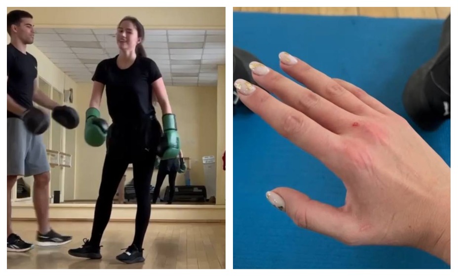 Загитова получила небольшую травму из-за занятий боксом.
Фото: Личная страница Алины Загитовой в соцсетях