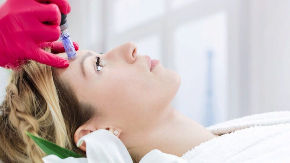 Фракционная мезотерапия лица в 2025 году