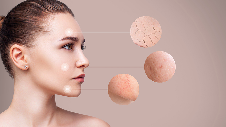 Сухая кожа лица